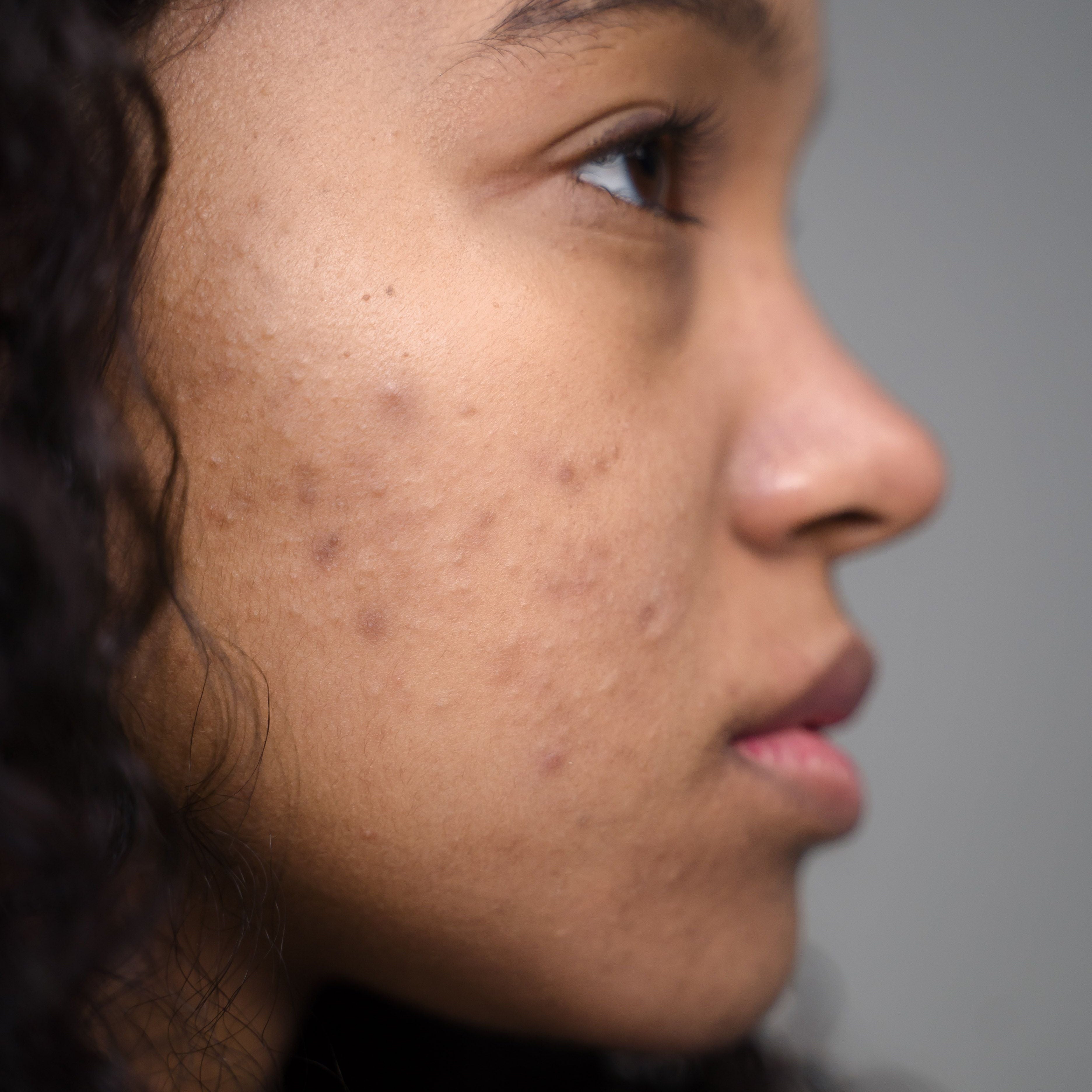 What Is Chronic Cleansing Stress — and Why It's Different from Occasional Sensitivity - The Skinbeneath